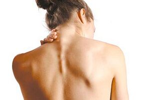 Síntomas dunha osteocondrose pescozo